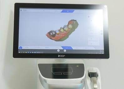 口腔内スキャナー