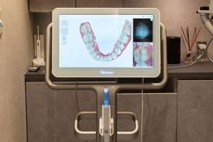 梅田アップル歯科iTero5D2