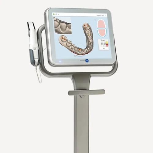 口腔スキャナー（I-TERO）